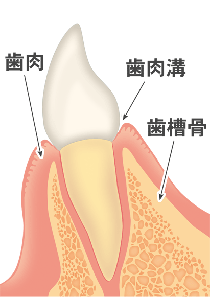 歯周病の進行